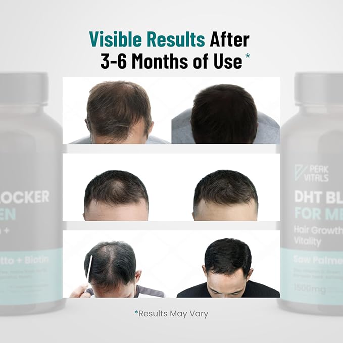 DHT Blocker for Men | Ultra Potent Hair Growth Formula | Saw Palmetto, Biotin, Pumpkin Seed, Herbal Extracts | Natural Hair Loss Supplements | Hair Regrowth Vitamins | Made in The USA | 90 Capsules