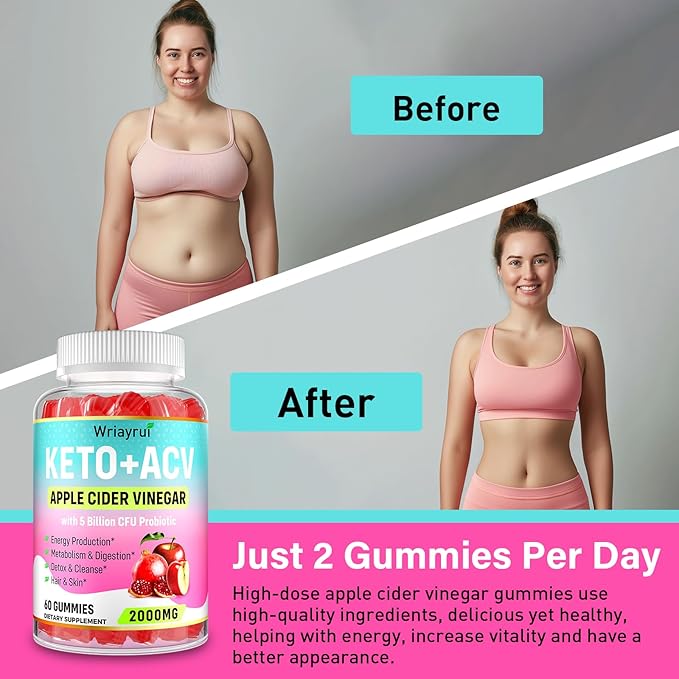 Apple Cider Vinegar Gummies, Keto ACV Gummies 2000mg, Formulated with Green Tea Extract, Probiotics & B12, ACV Gummies for Metabolism, Digestion, 360 Gummies