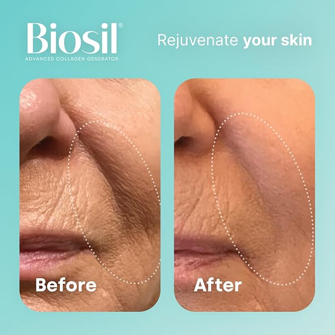 Biosil Collagen Generator - 1 fl oz Drops - with Patented ch-OSA Complex - Generates & Protects Your Own Collagen - GMO Free - 60-Day Supply